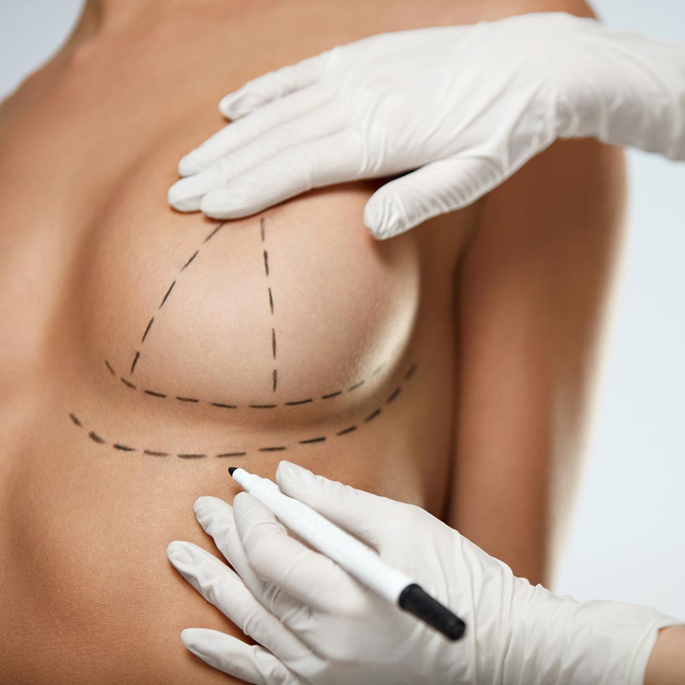 Ästhetische Chirurgie Bruststraffung