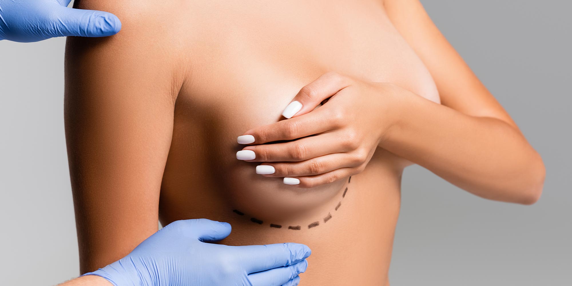 Ästhetische Chirurgie Brustvergrößerung mit Eigenfett